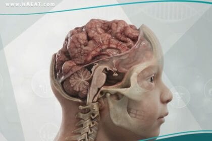 _انعدام الدماغ