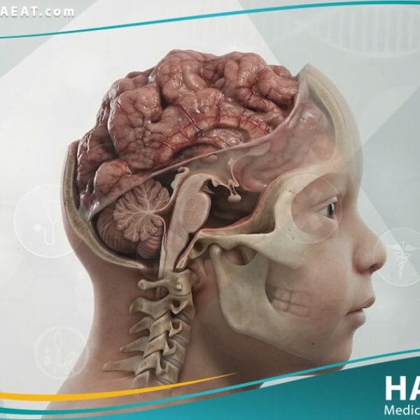 _انعدام الدماغ