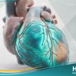 تشخيص الذبحة الصدرية