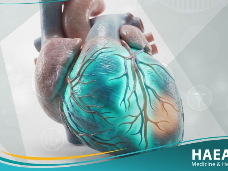 تشخيص الذبحة الصدرية