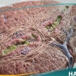 _تشمع المرارة الأولي