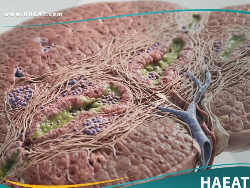 _تشمع المرارة الأولي