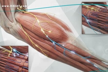 تشنج العضلات