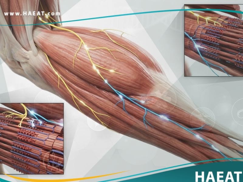 تشنج العضلات