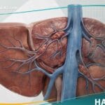 _تشوه باد-خياري