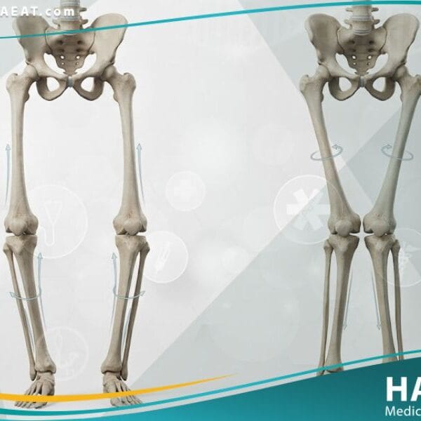 تشوهات تدويرية وزاوية في الرجلين