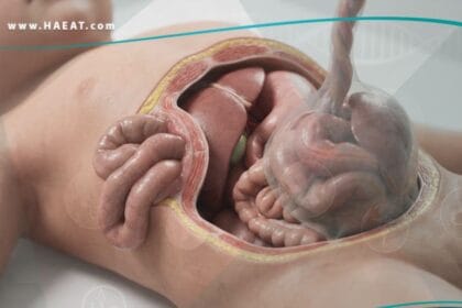 _تشوهات خلقية في جدار البطن