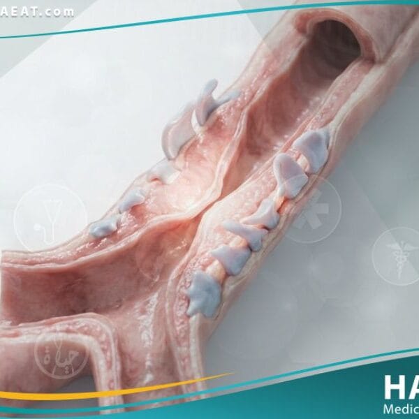 تشوهات خلقية في ممرات الهواء