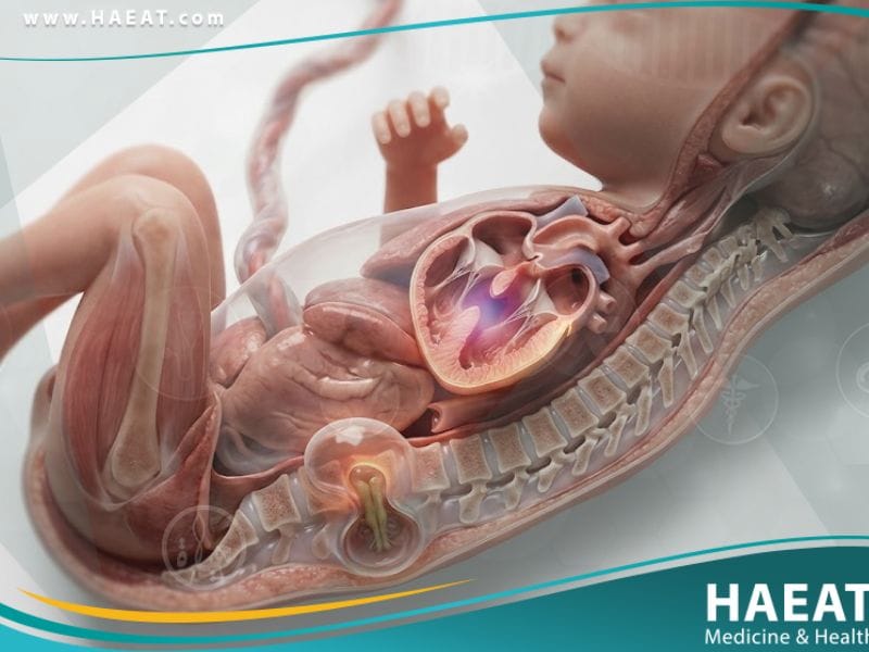 _تشوهات خلقية