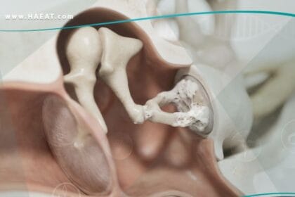 تصلب الأذن الوسطى