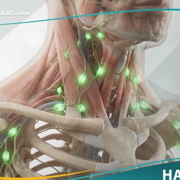 تضخم العقد اللمفية