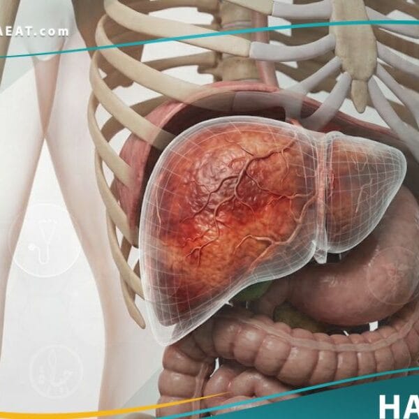 تضخم الكبد (1)