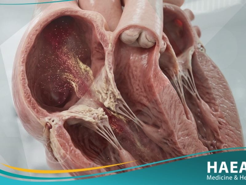 تضيق الثلاثي الشرف