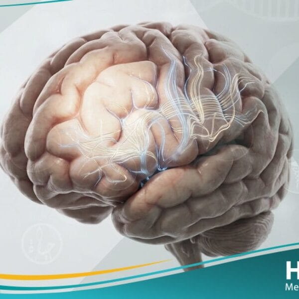 تعذر الأداء