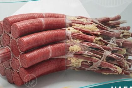 حثل العضلات (1)