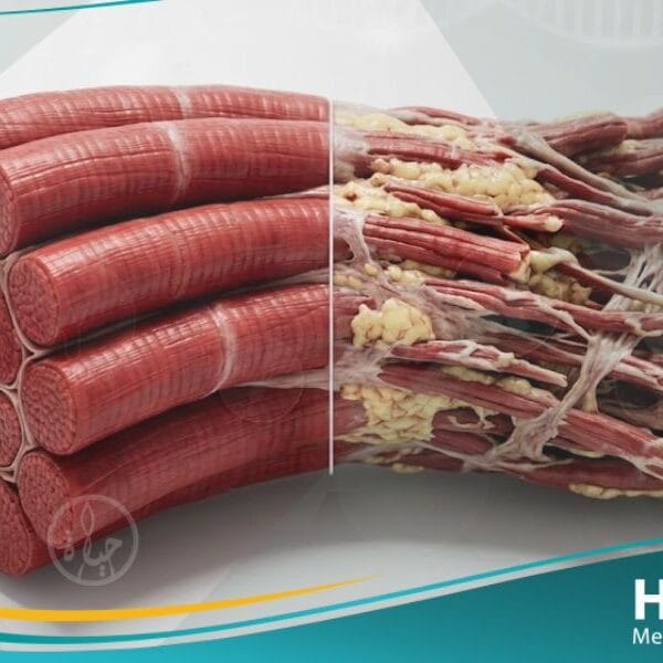 حثل العضلات (1)