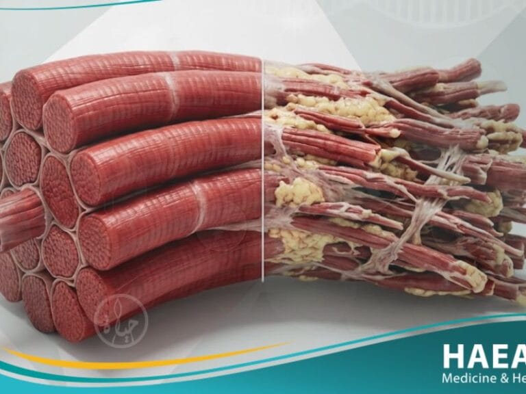 حثل العضلات (1)