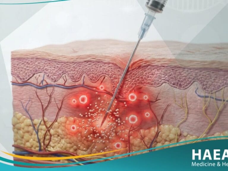 حساسية الإنسولين