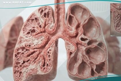 خلل التنسج القصبي الرئوي