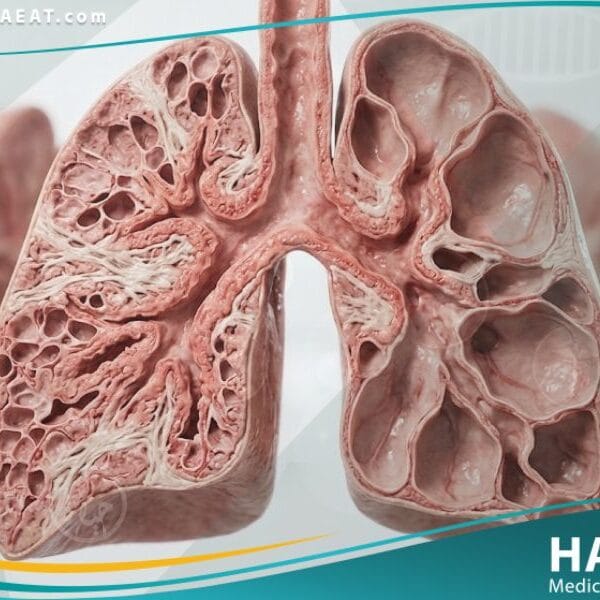 خلل التنسج القصبي الرئوي