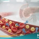 خلل في الجلوكوز بالصوم