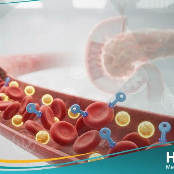 خلل في الجلوكوز بالصوم