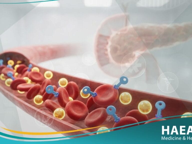 خلل في الجلوكوز بالصوم