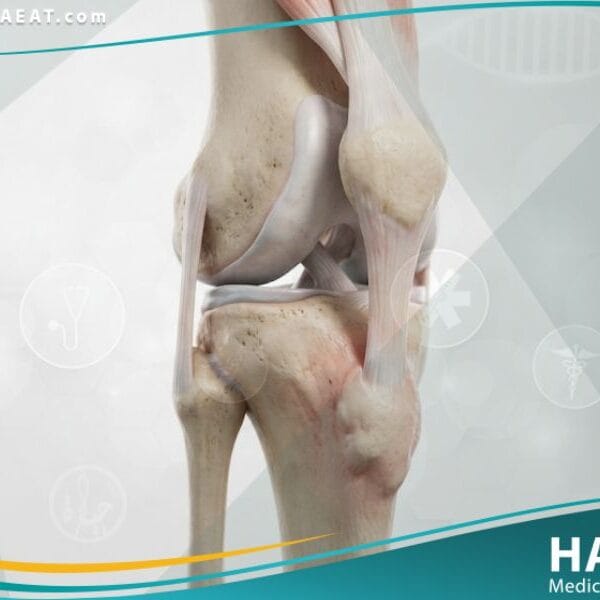 داء أوزغـود - شلاتـر