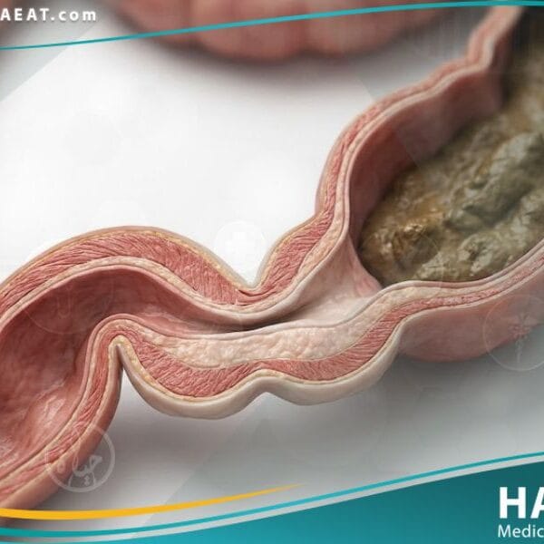 داء هيرشسبرونغ (2)