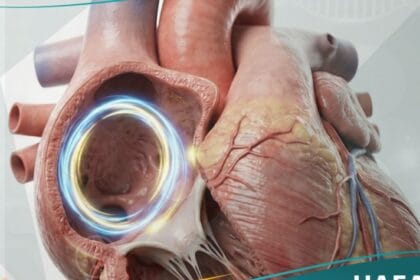 رفرفة أذينية