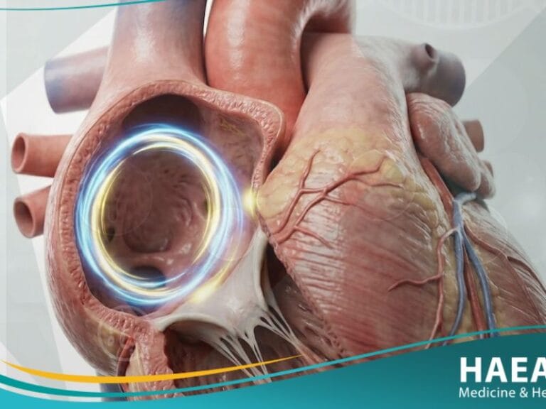 رفرفة أذينية