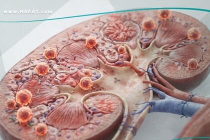 _رفض الأعضاء المزروعة