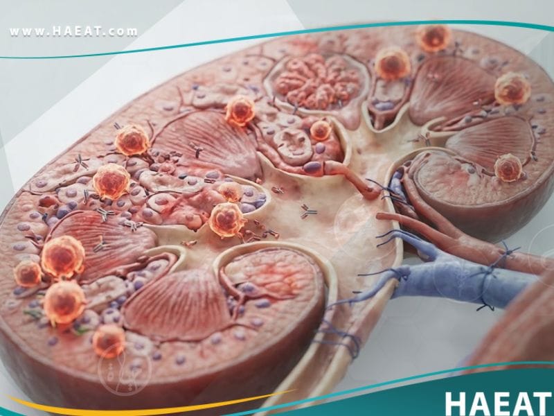 _رفض الأعضاء المزروعة