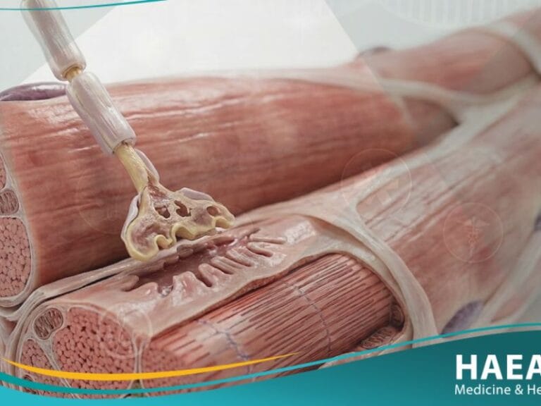 زوال التعصيب العضلي