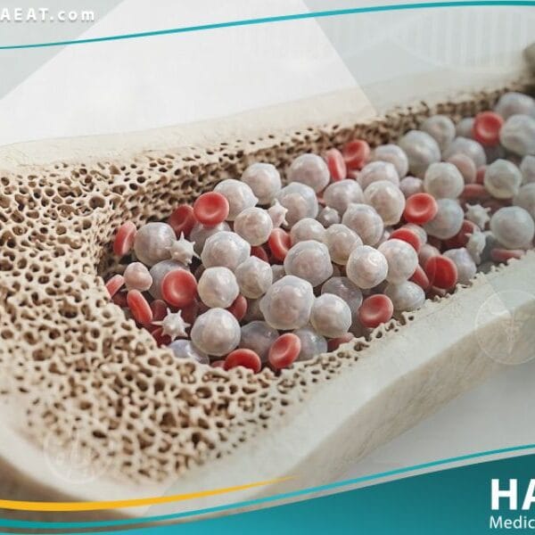 سرطان الدم عند الأطفال