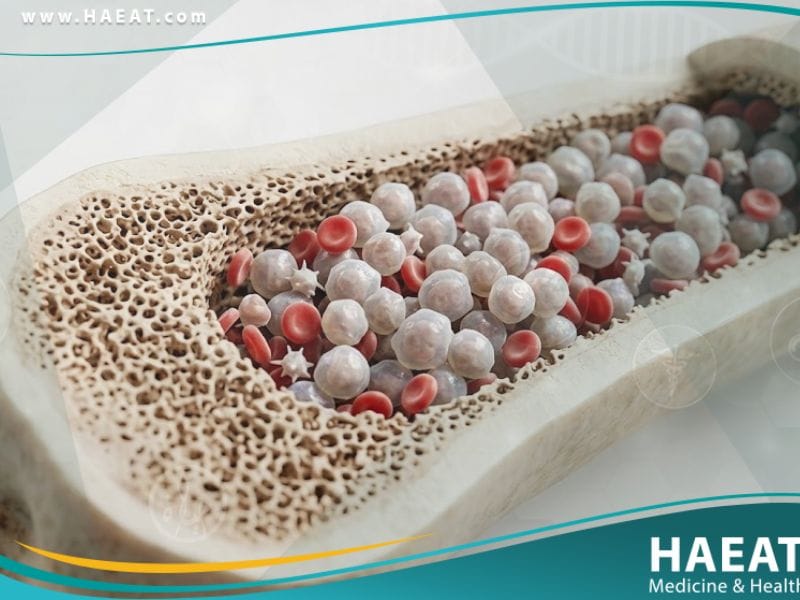 سرطان الدم عند الأطفال