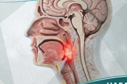 سرطان الرأس (1)