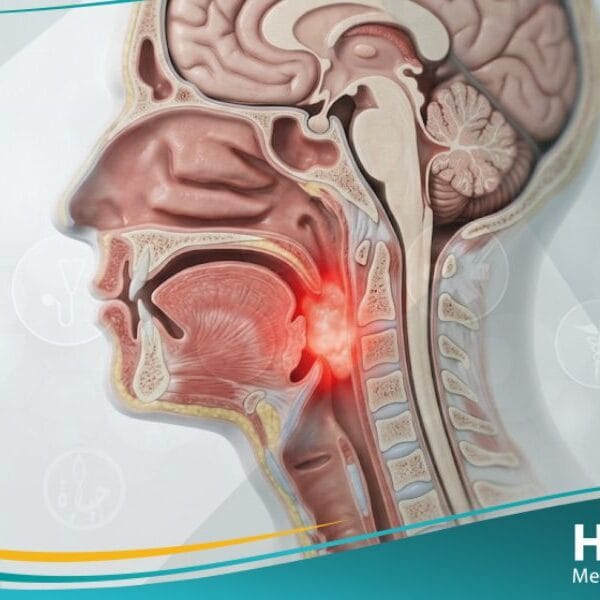 سرطان الرأس (1)