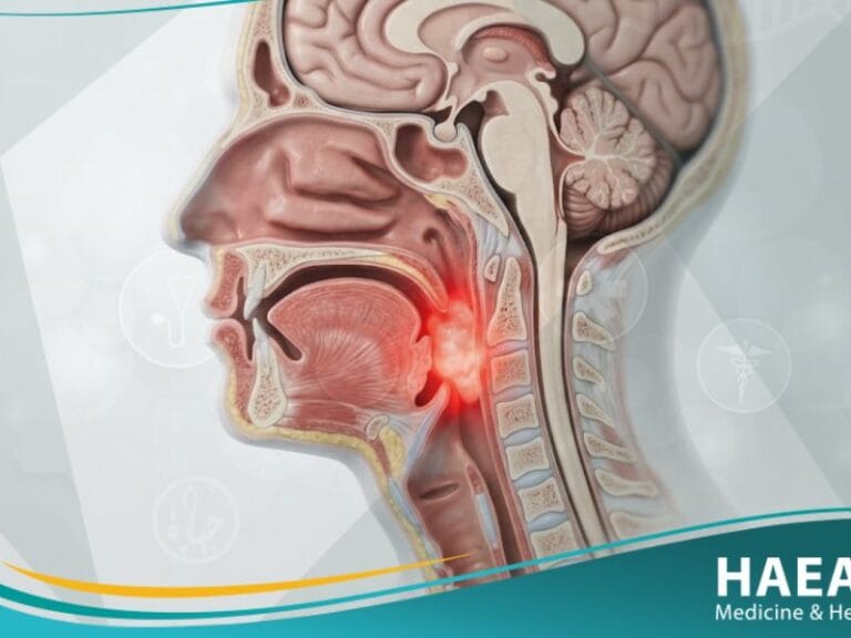 سرطان الرأس (1)