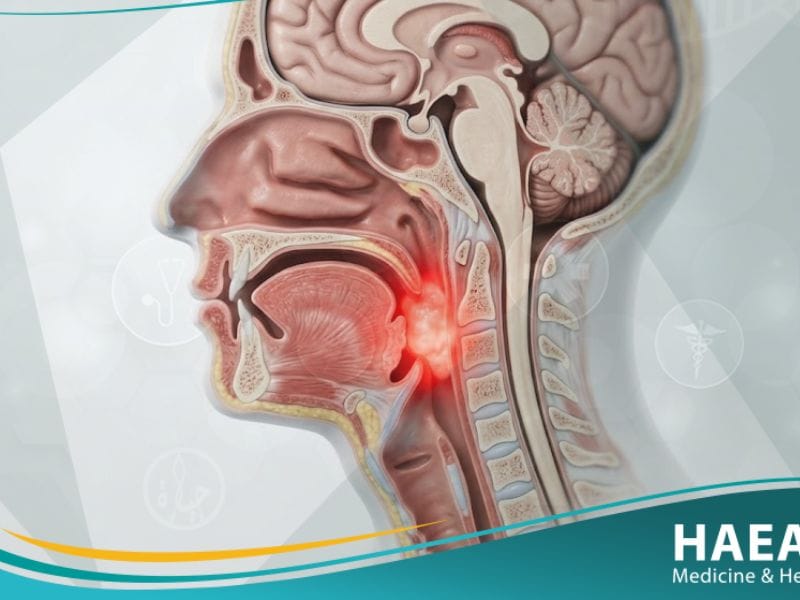 سرطان الرأس (1)