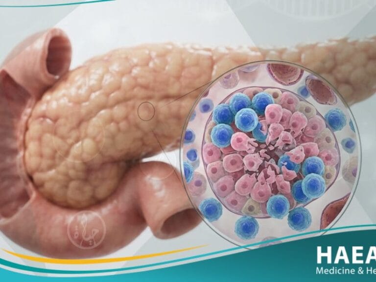 _سكري من النمط 1