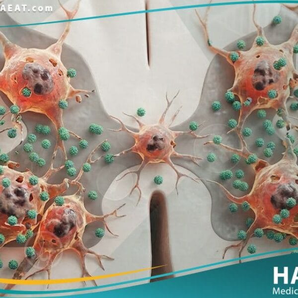 شلل الأطفال