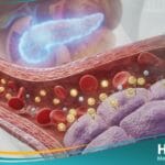 ضعف تحمل الجلوكوز