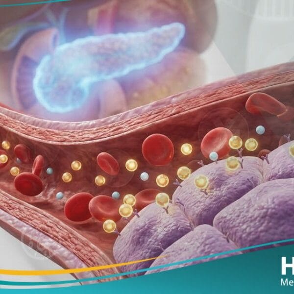 ضعف تحمل الجلوكوز