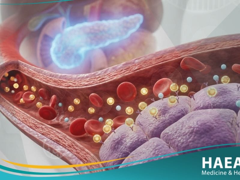 ضعف تحمل الجلوكوز