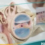 _ضعف سمع في الأذن الداخلية