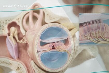 _ضعف سمع في الأذن الداخلية