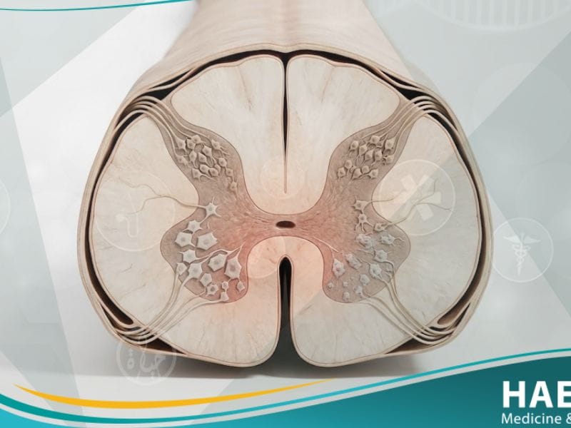 ضمور النخاع الشوكي