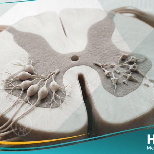 _ضمور النخاع الشوكي