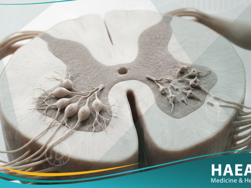 _ضمور النخاع الشوكي